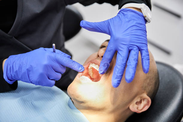 Best Emergency Wisdom Teeth Removal in Kinnelon, NJ